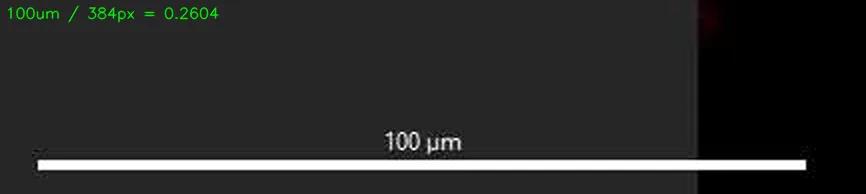 Reading the scale bar