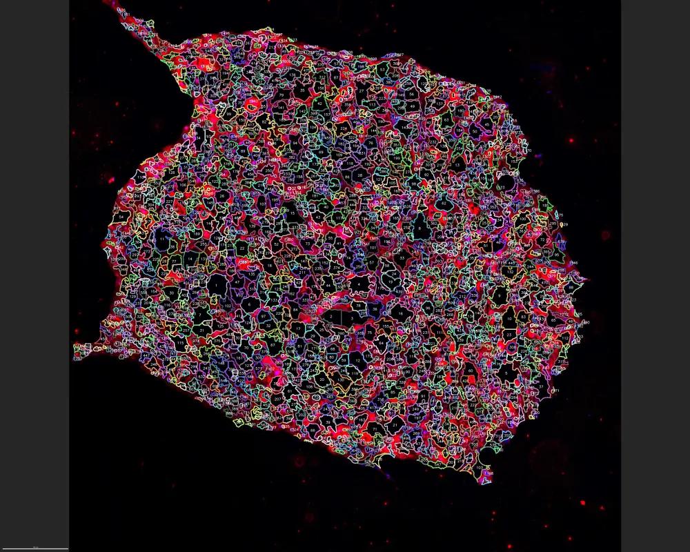 A dense region where fibers crowd, each counted separately