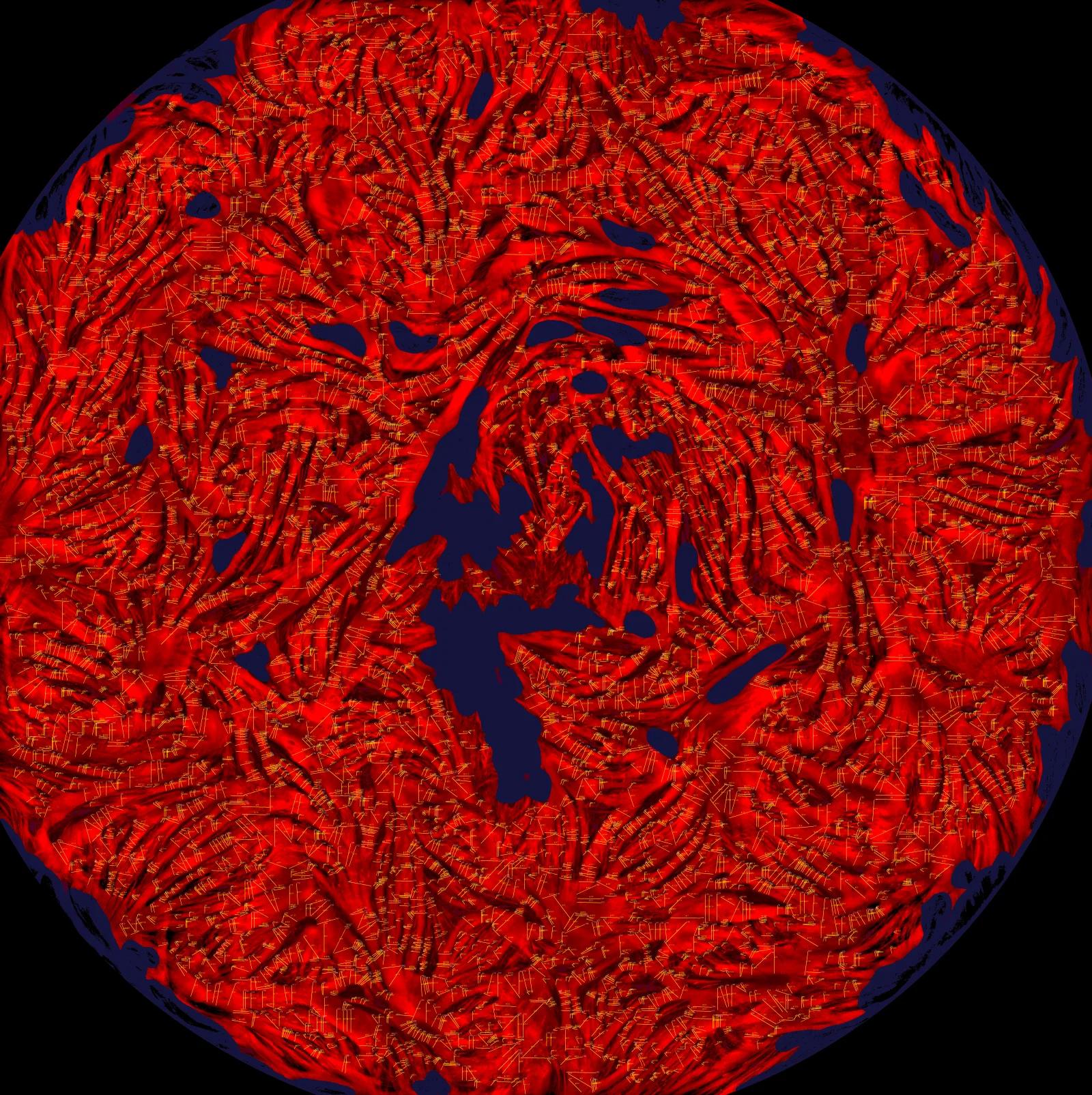 Muscle-tissue microscopy image with every fiber marked by width and a measurement ID